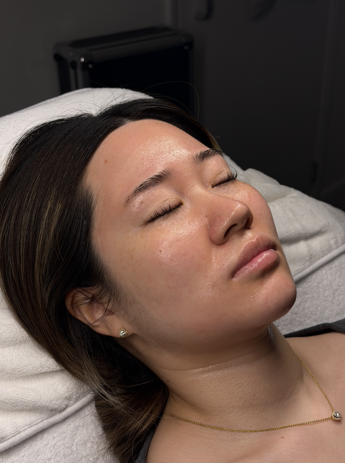 Facial treatment result - glowing skin